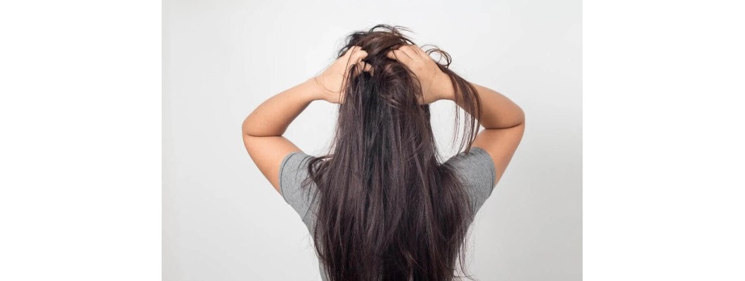 Eliminating Head Lice: A Comprehensive Guide Eliminating Head Lice: A Comprehensive Guide