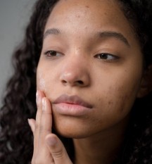 Salicylic Acid: Unveiling the Gentle Giant of Acne Fighters