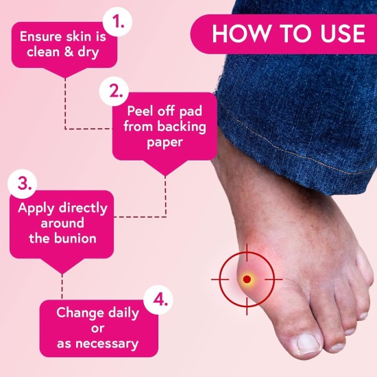 Carnation Bunion Oval Pads Pack Of 4