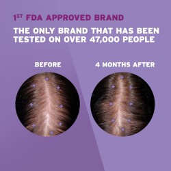 Regain Women Regular Strength 2% Minoxidil Regain Women Regular Strength 2% Minoxidil