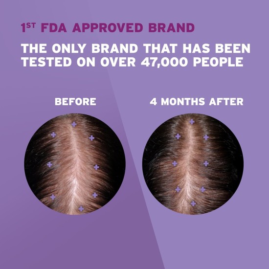 Regain Women Regular Strength 2% Minoxidil Regain Women Regular Strength 2% Minoxidil