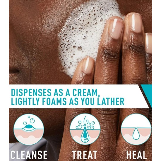 CeraVe Acne Foaming Cream Cleanser 150ml CeraVe Acne Foaming Cream Cleanser 150ml
