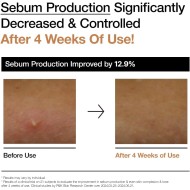 ANUA Rice 70 Glow Milky Toner 250ml