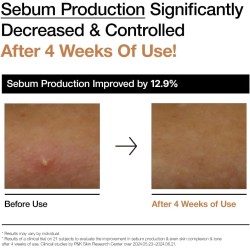 ANUA Rice 70 Glow Milky Toner 250ml ANUA Rice 70 Glow Milky Toner 250ml