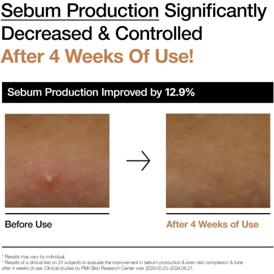 ANUA Rice 70 Glow Milky Toner 250ml ANUA Rice 70 Glow Milky Toner 250ml