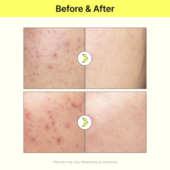 TIAM Vitamin B3 Source Niacinamide 40ml