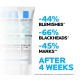 La Roche-posay Innovation Effaclar Duo+ 40ml