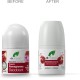 Dr Organic Pomegranate Deodorant 50ml
