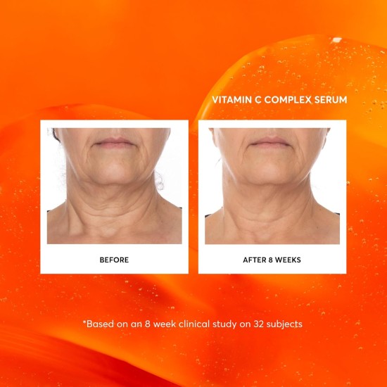 Naturium Vitamin C Complex Serum 30ml