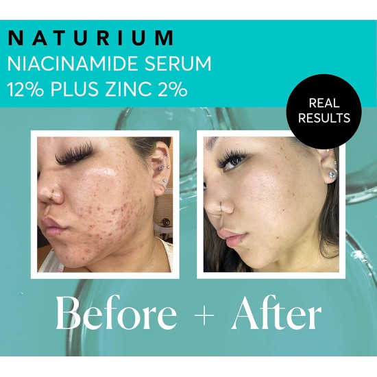 Naturium Niacinamide Serum 12% Plus Zinc 2% 30ml