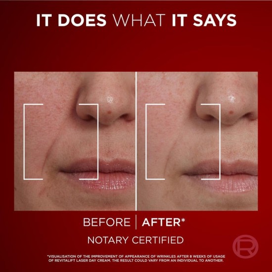 L’Oréal Paris Laser Renew Triple Action Anti-Ageing Day Cream 50ml