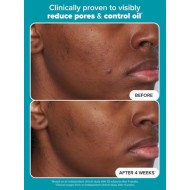 Paula's Choice Skin Perfecting 2% Bha Liquid Exfoliant 118ml