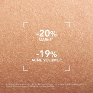 Bioderma Sébium Kerato + Anti-Blemish Gel Cream 30ml