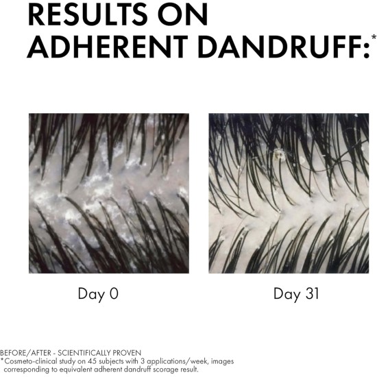 Vichy Antidandruff Shampoo Dry