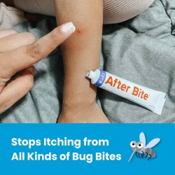 After Bite Kids Insect Bite Cream for Children 20g